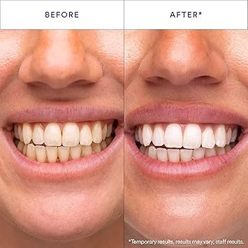 HiSmile PAP+ Teeth Whitening Kit