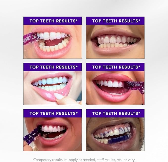 HiSmile PAP+ Teeth Whitening Kit