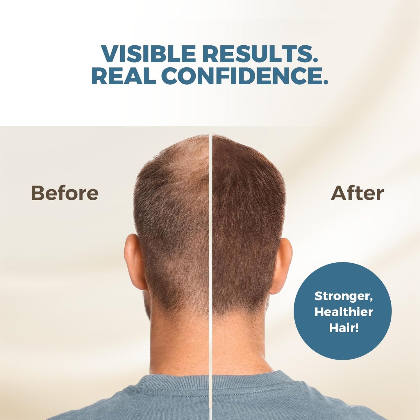 Advanced Hair Growth Serum Roll