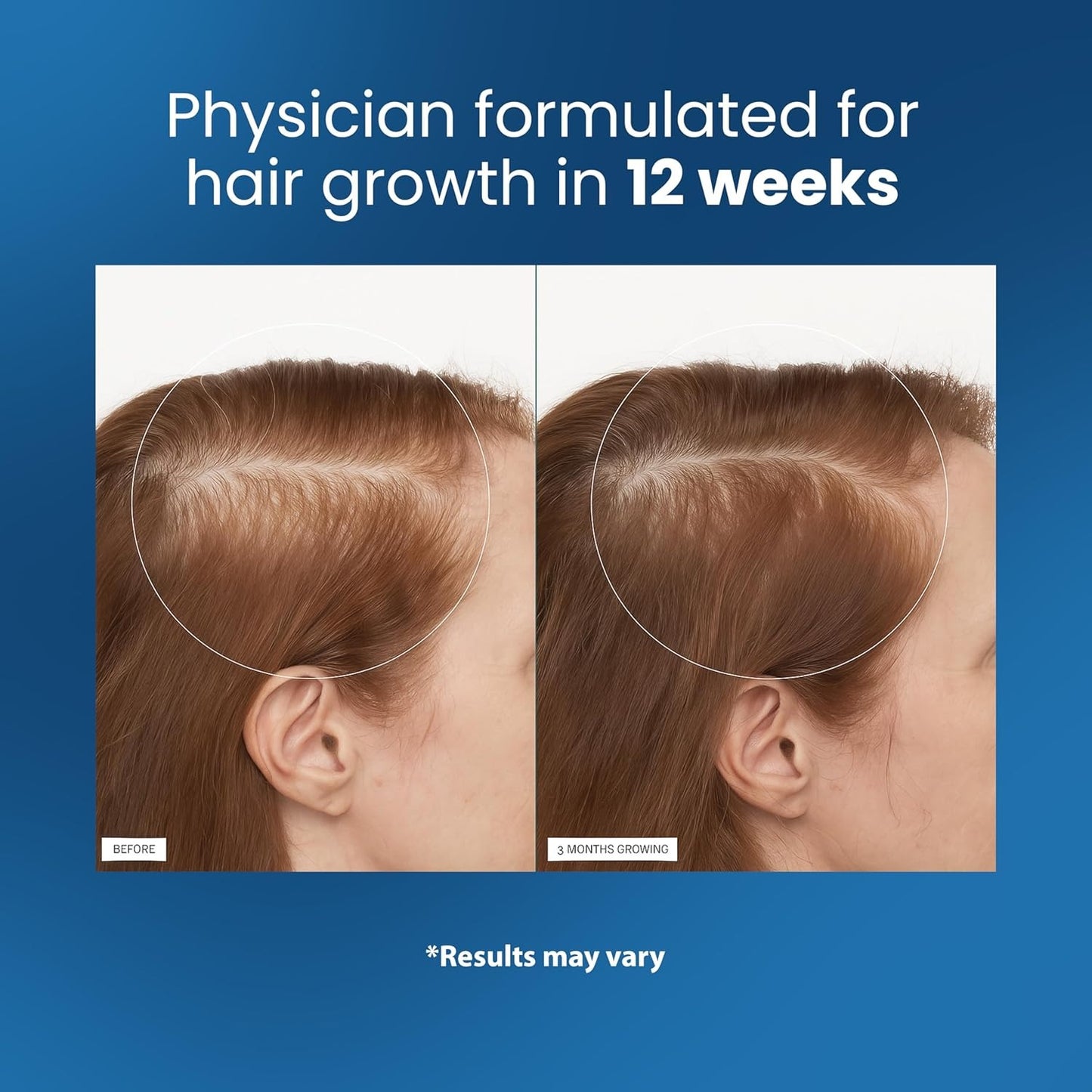 Advanced Hair Growth Serum Roll