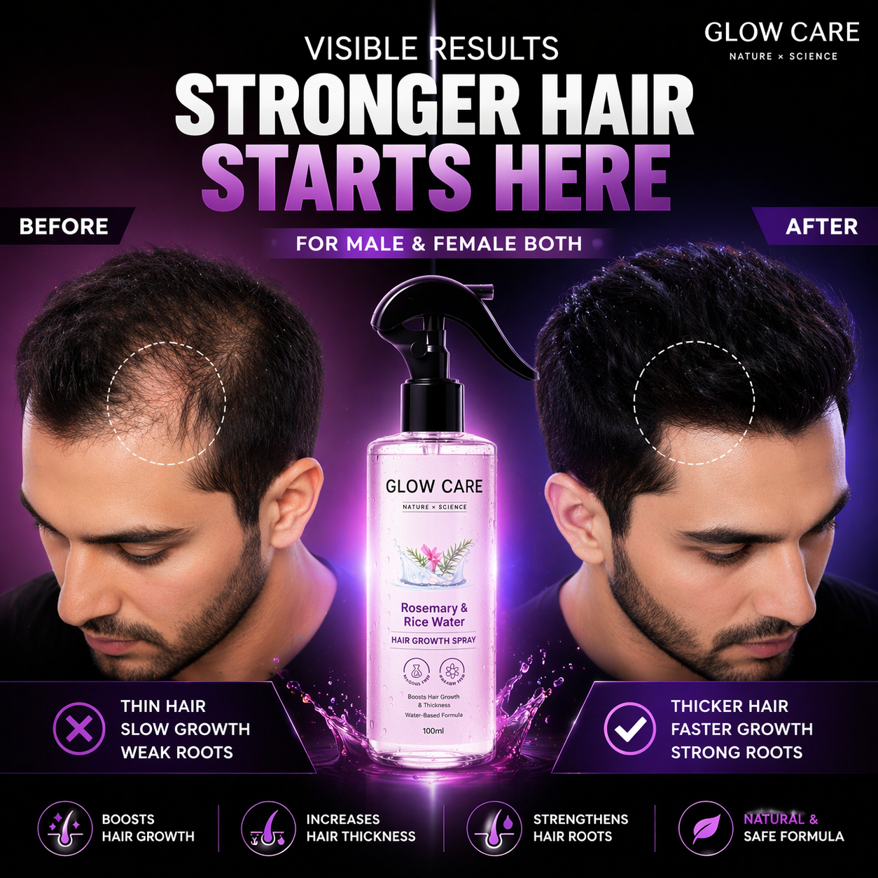 Rosemary & Rice Water Hair Growth Spray