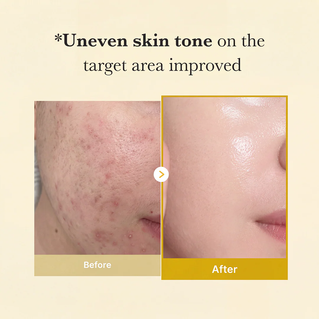 KOJIC ACID TURMERIC WRAPPING MASK
