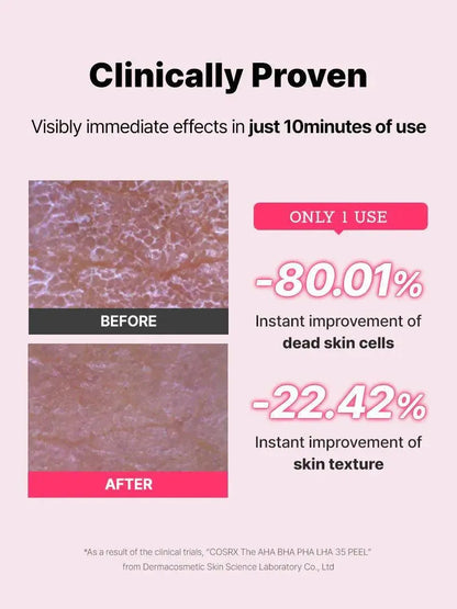 COSRX AHA BHA PHA LHA 35%